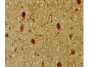 p130 Rb2 Antibody in Immunohistochemistry (Paraffin) (IHC (P))
