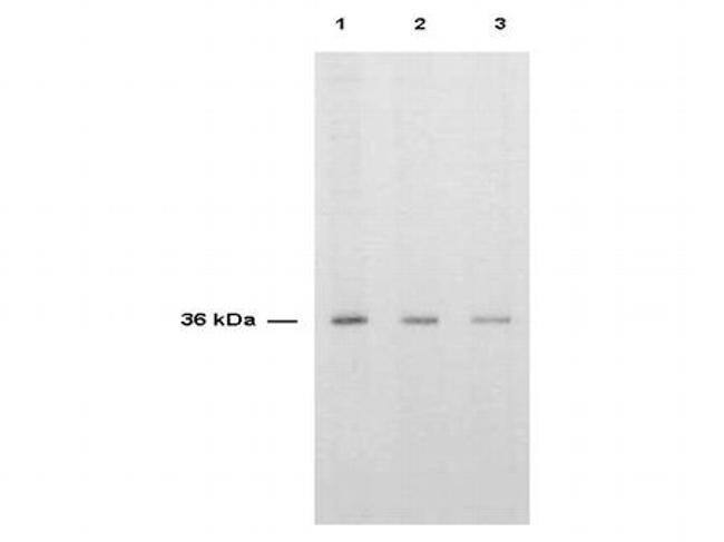 Thymidylate Synthase Antibody in Western Blot (WB)