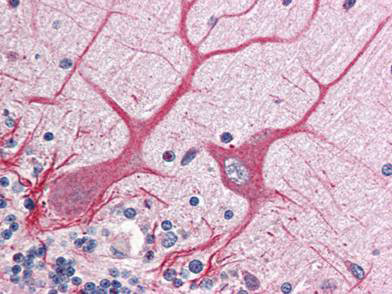 NOTCH 1 Antibody in Immunohistochemistry (Paraffin) (IHC (P))