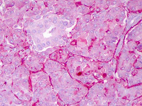 NOTCH 1 Antibody in Immunohistochemistry (Paraffin) (IHC (P))