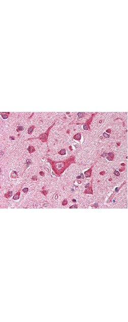 CaM Kinase IV Antibody in Immunohistochemistry (Paraffin) (IHC (P))