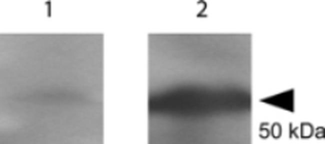 Tetanus Toxic Fragment C Antibody in Western Blot (WB)