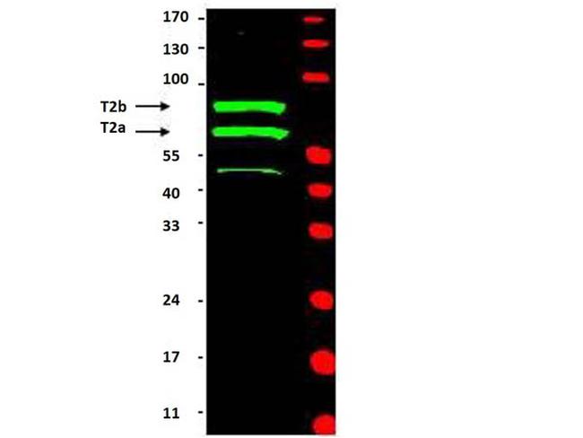 Cyclin T2 Antibody in Western Blot (WB)