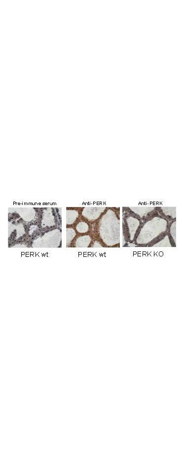 PERK Antibody in Immunohistochemistry (IHC)