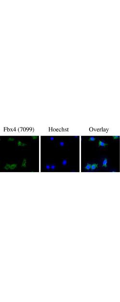 FBXO4 Antibody in Immunocytochemistry (ICC/IF)
