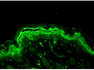 Erk1/2 Antibody in Immunocytochemistry (ICC/IF)