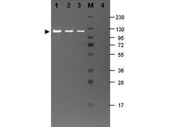 beta Galactosidase Antibody in Western Blot (WB)