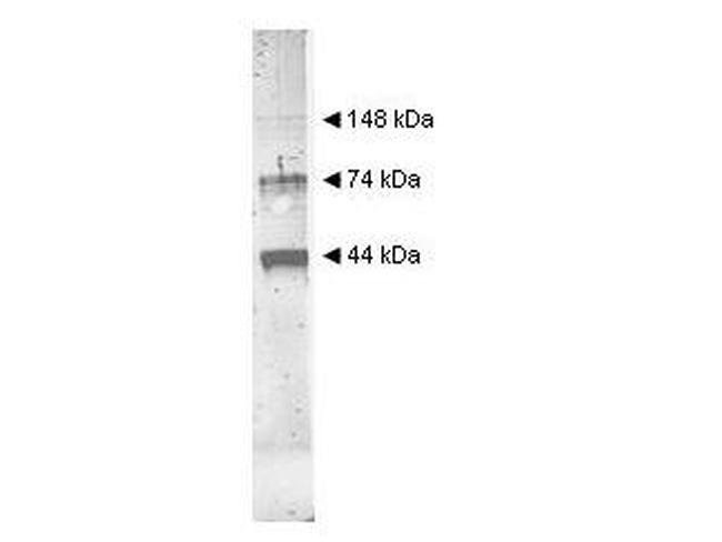 Alcohol Dehydrogenase Antibody in Western Blot (WB)