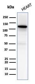 N-Cadherin/Cadherin-2/CD325 (NCAD) Antibody in Western Blot (WB)