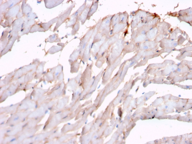 N-Cadherin/Cadherin-2/CD325 (NCAD) Antibody in Immunohistochemistry (Paraffin) (IHC (P))