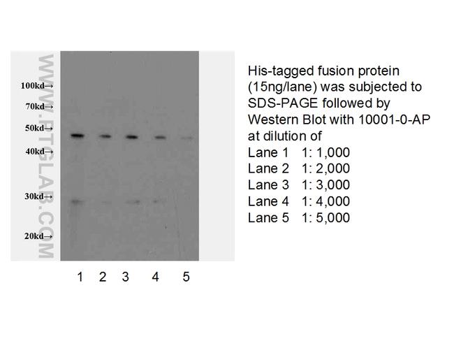 His tag Antibody in Western Blot (WB)