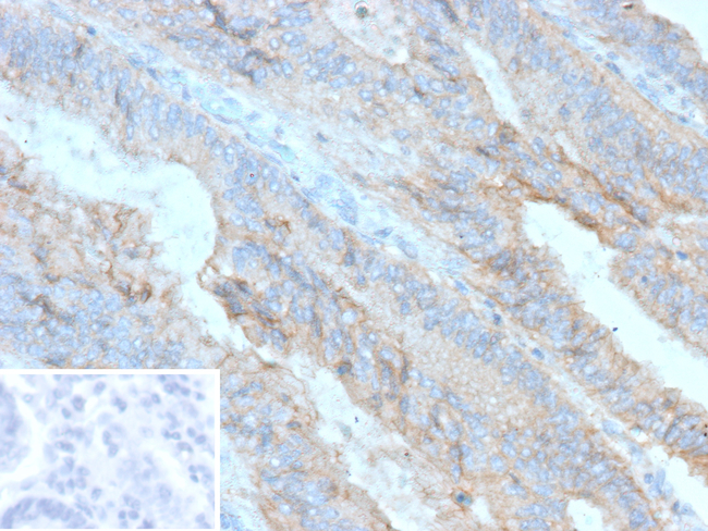 P-Cadherin (CDH3) (Basal Epithelial Cell Marker) Antibody in Immunohistochemistry (Paraffin) (IHC (P))