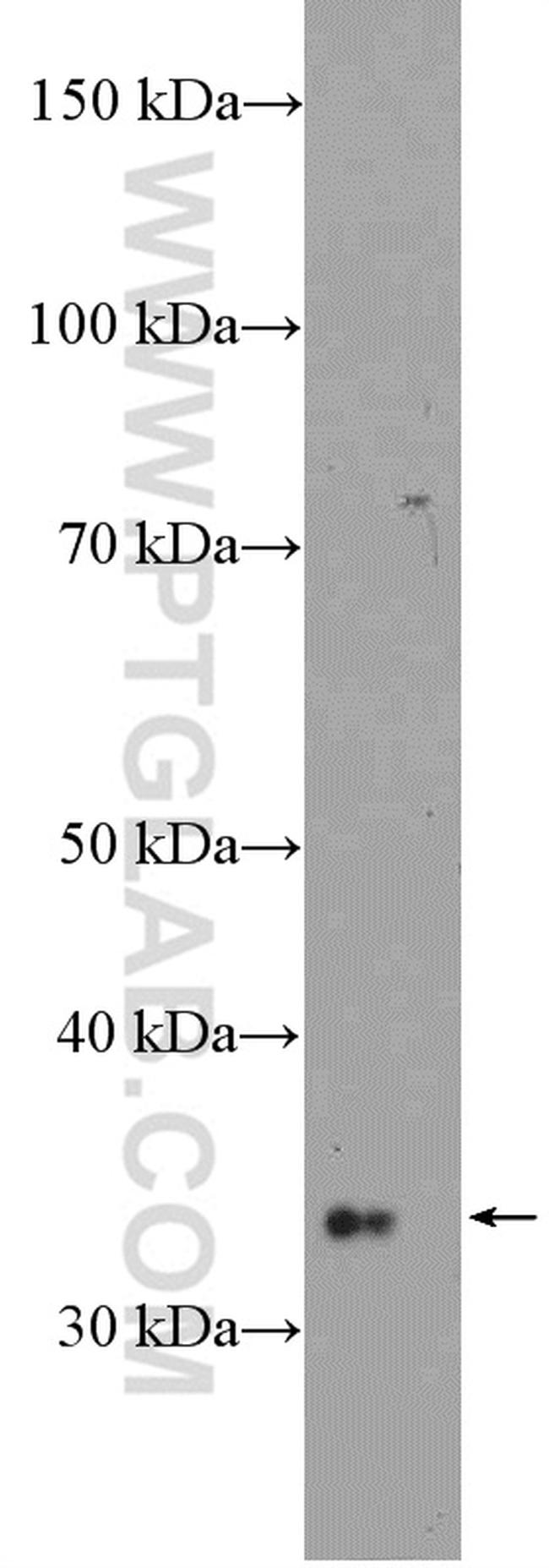 Phospho-MARCKS (Ser93, Ser97, Ser104) Antibody in Western Blot (WB)