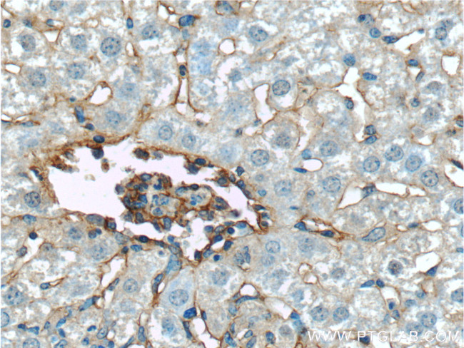 Icam-1 Antibody in Immunohistochemistry (Paraffin) (IHC (P))