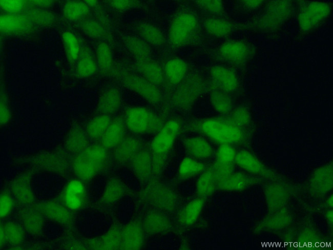 AP1/JUN/P39 Antibody in Immunocytochemistry (ICC/IF)