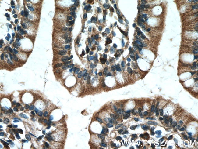 PDK1 Antibody in Immunohistochemistry (Paraffin) (IHC (P))