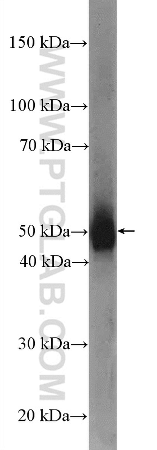 Dynamitin (1-83 AA) Antibody in Western Blot (WB)