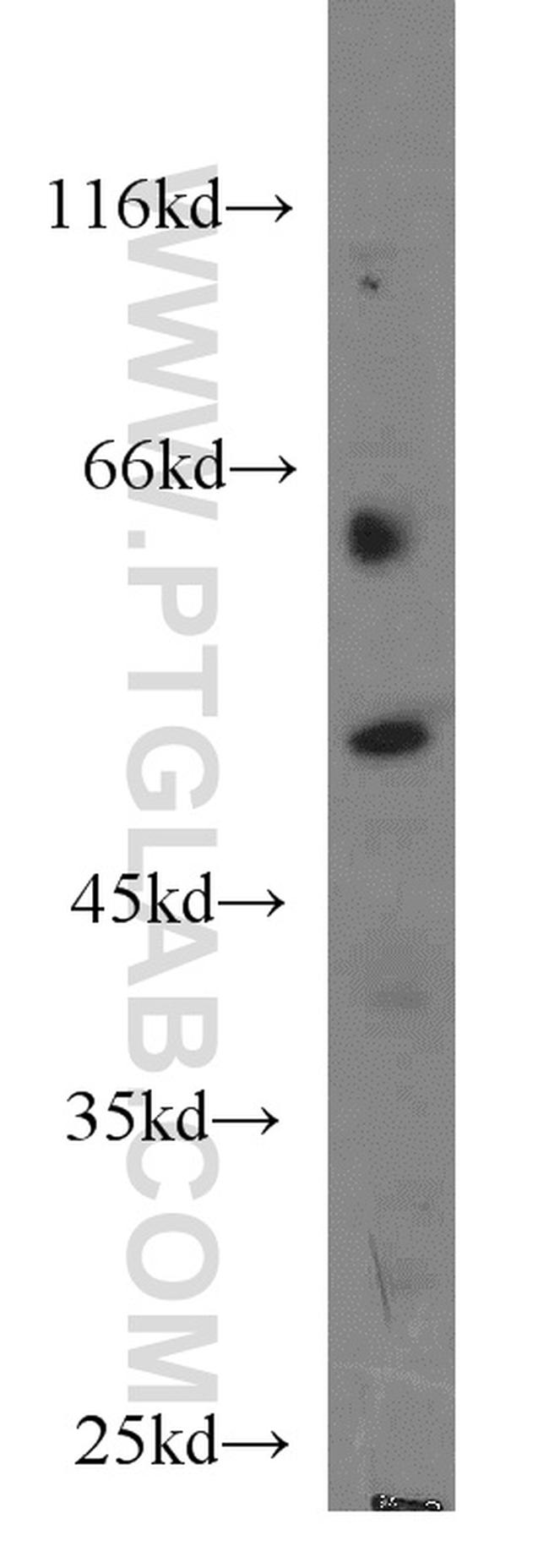 Dynamitin (1-86 AA) Antibody in Western Blot (WB)
