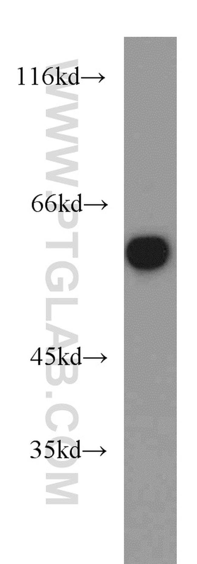 MAPK7 Antibody in Western Blot (WB)