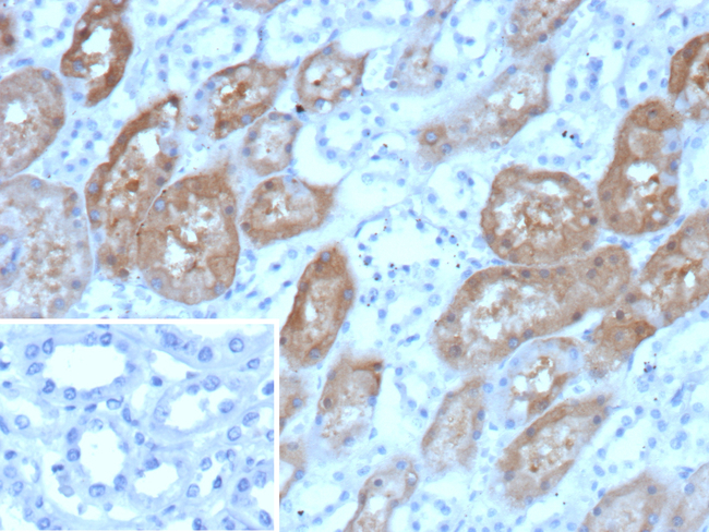 Cadherin-6 (CDH6)/K-Cadherin Antibody in Immunohistochemistry (Paraffin) (IHC (P))