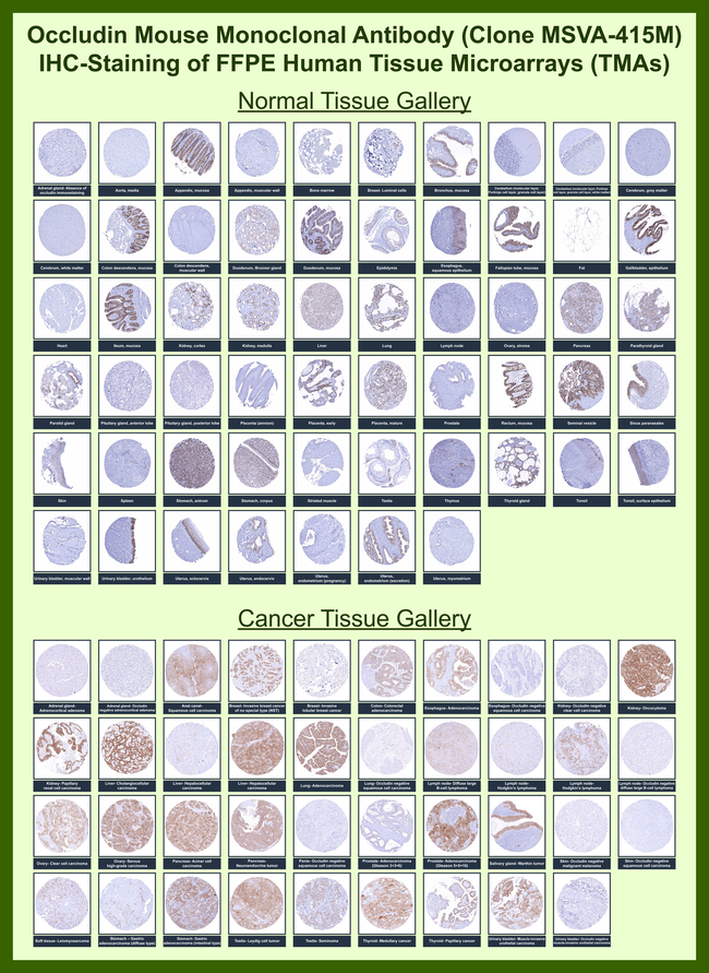 Occludin (Marker of Early Blood Brain Barrier Damage) Antibody in Immunohistochemistry (Paraffin) (IHC (P))