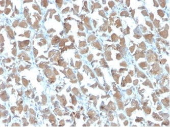 MICA Antibody in Immunohistochemistry (Paraffin) (IHC (P))