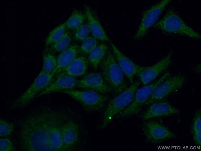 SHC Antibody in Immunocytochemistry (ICC/IF)