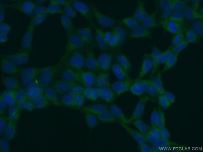 OS9 Antibody in Immunocytochemistry (ICC/IF)
