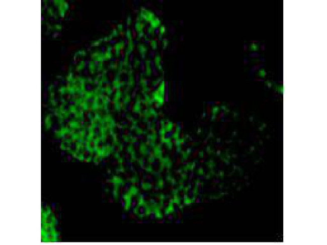 Amyloid Beta A4 Precursor (APP) Antibody in Immunocytochemistry (ICC/IF)