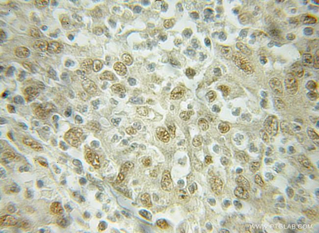 Importin beta Antibody in Immunohistochemistry (Paraffin) (IHC (P))