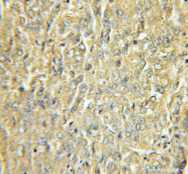OLFM1 Antibody in Immunohistochemistry (Paraffin) (IHC (P))