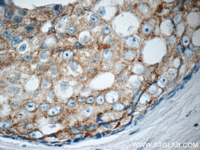 MATK Antibody in Immunohistochemistry (Paraffin) (IHC (P))