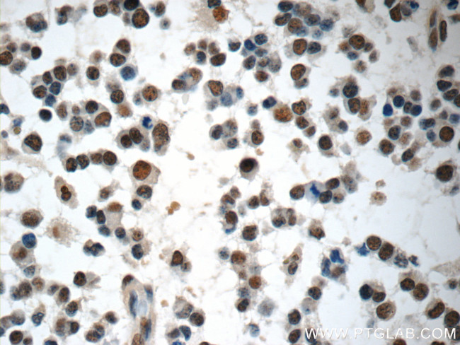 COPS8/COP9 Antibody in Immunohistochemistry (Paraffin) (IHC (P))