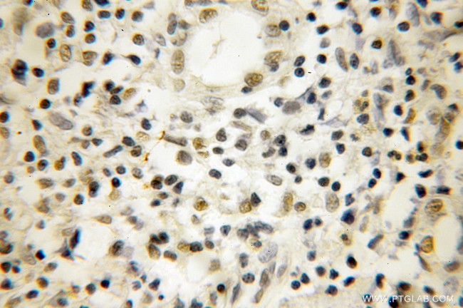 NOB1 Antibody in Immunohistochemistry (Paraffin) (IHC (P))