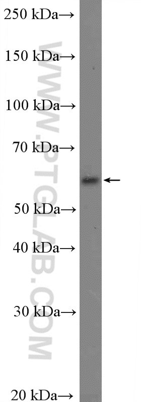 KCNS3 Antibody in Western Blot (WB)
