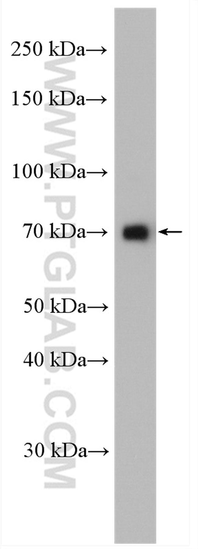 GTF2F1 Antibody in Western Blot (WB)