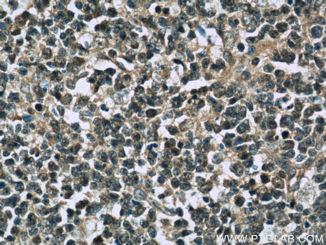 TFPT Antibody in Immunohistochemistry (Paraffin) (IHC (P))