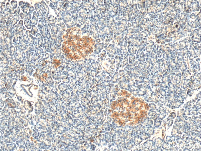 PCTAIRE1 Antibody in Immunohistochemistry (Paraffin) (IHC (P))