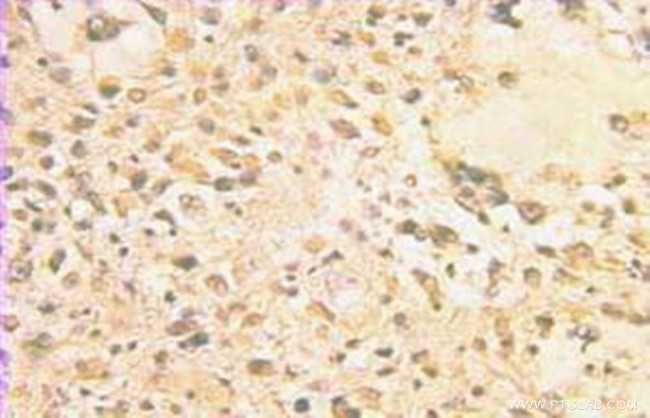 GPAA1 Antibody in Immunohistochemistry (Paraffin) (IHC (P))