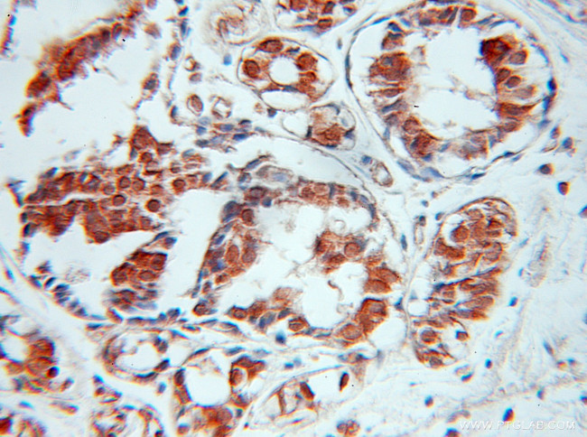 SPIN2B Antibody in Immunohistochemistry (Paraffin) (IHC (P))