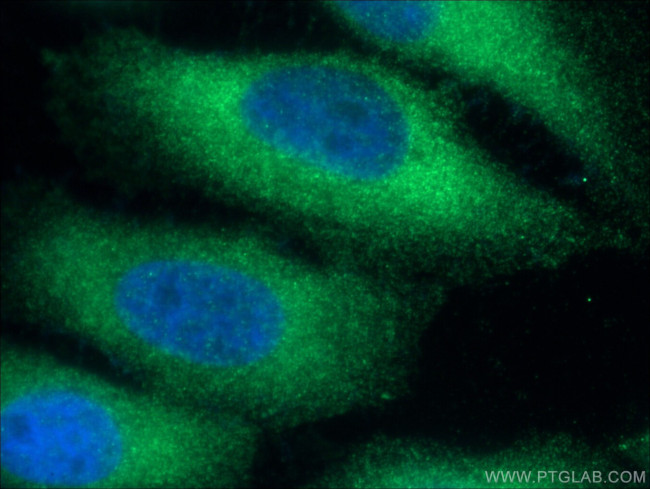 NUMBL Antibody in Immunocytochemistry (ICC/IF)