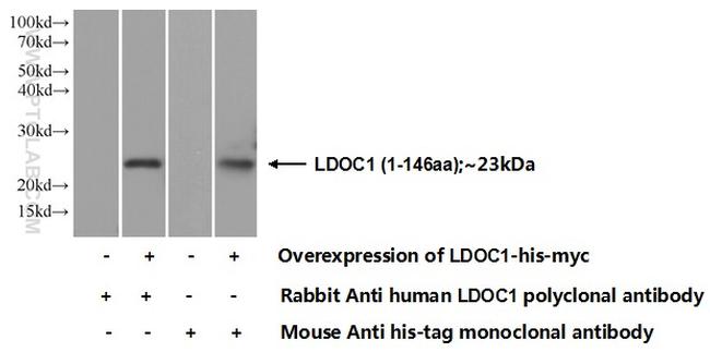 LDOC1 Antibody in Western Blot (WB)