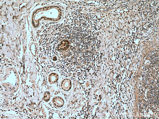 CORO2A Antibody in Immunohistochemistry (Paraffin) (IHC (P))