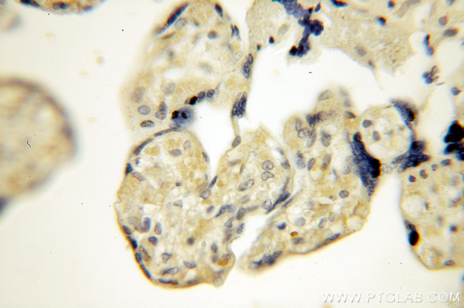 Calpain 6 Antibody in Immunohistochemistry (Paraffin) (IHC (P))