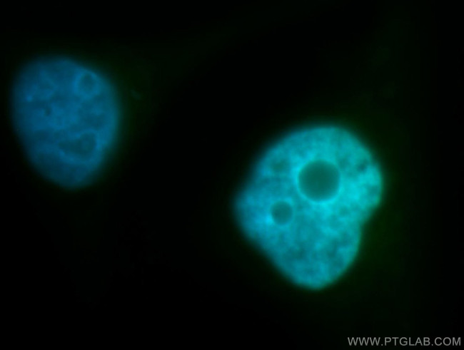 BUB3 Antibody in Immunocytochemistry (ICC/IF)