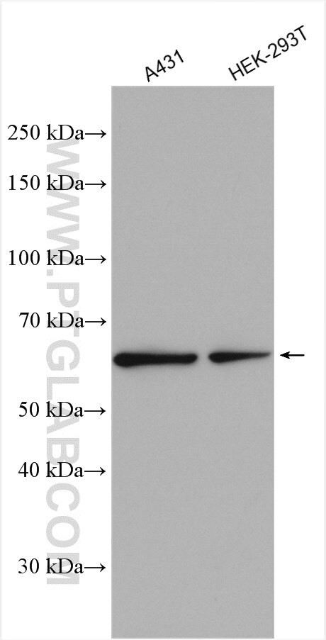 CPNE1 Antibody in Western Blot (WB)