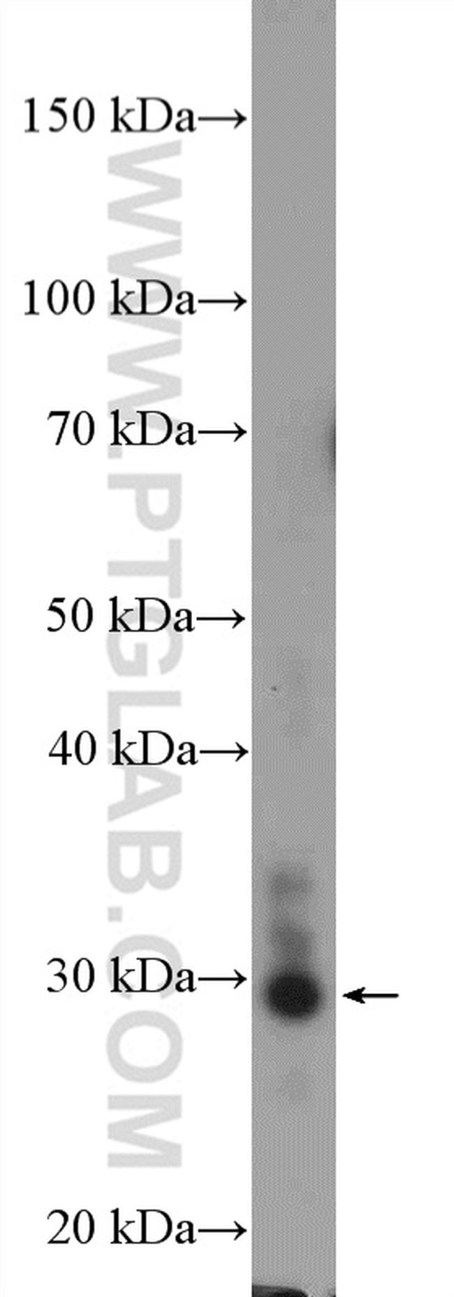 FUSIP1 Antibody in Western Blot (WB)