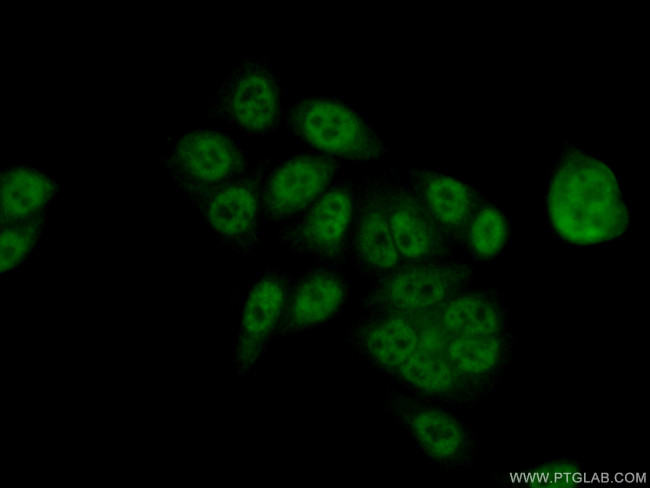 LSM8 Antibody in Immunocytochemistry (ICC/IF)