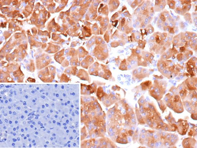 CELA3A/Chymotrypsin like elastase 3A Antibody in Immunohistochemistry (Paraffin) (IHC (P))