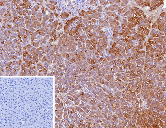 CELA3A/Chymotrypsin like elastase 3A Antibody in Immunohistochemistry (Paraffin) (IHC (P))